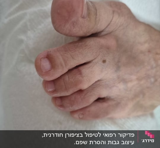 תמונה של כף רגל על רקע לבן